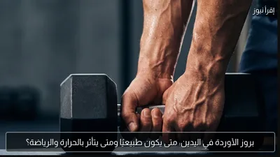 بروز الأوردة في اليدين: متى يكون طبيعيًا ومتى يتأثر بالحرارة والرياضة؟