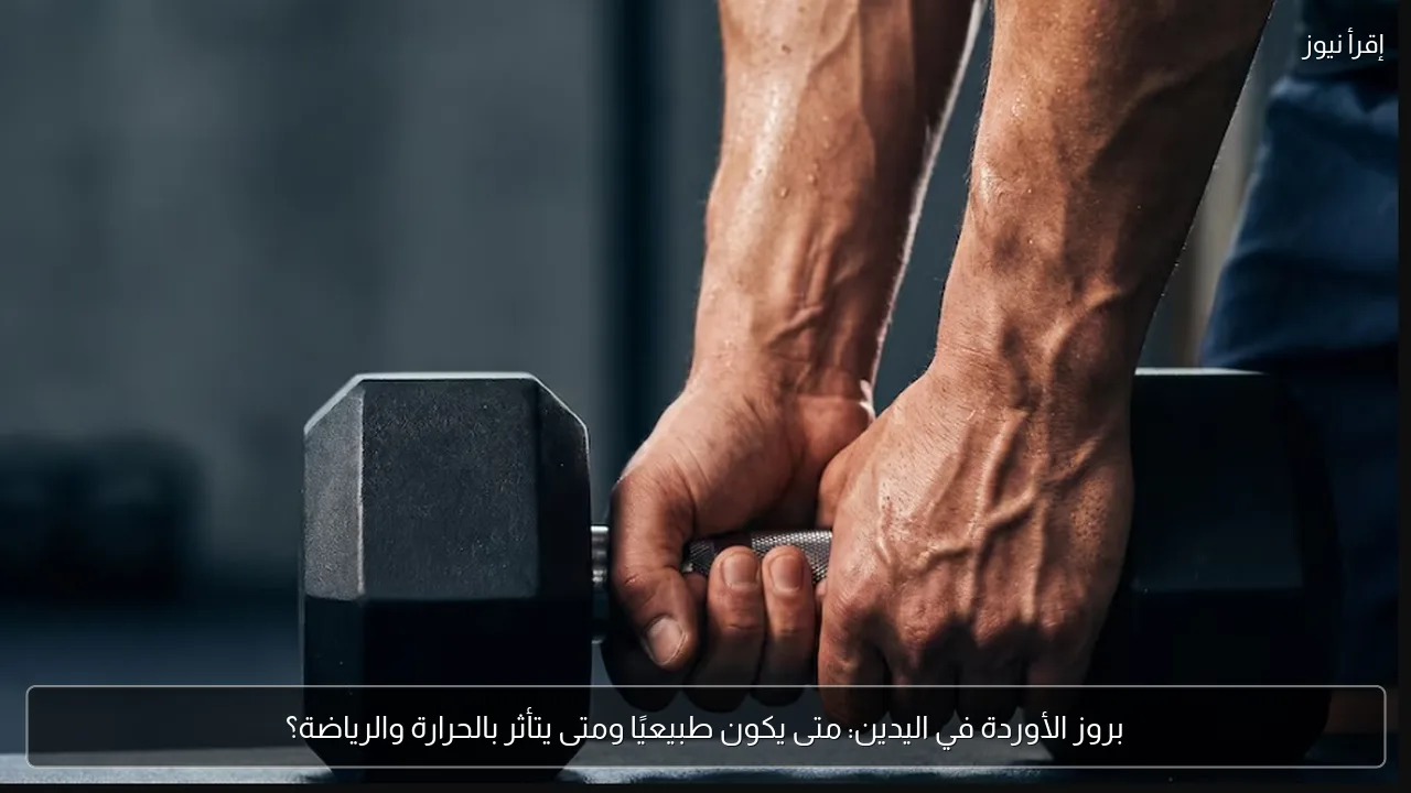 بروز الأوردة في اليدين: متى يكون طبيعيًا ومتى يتأثر بالحرارة والرياضة؟