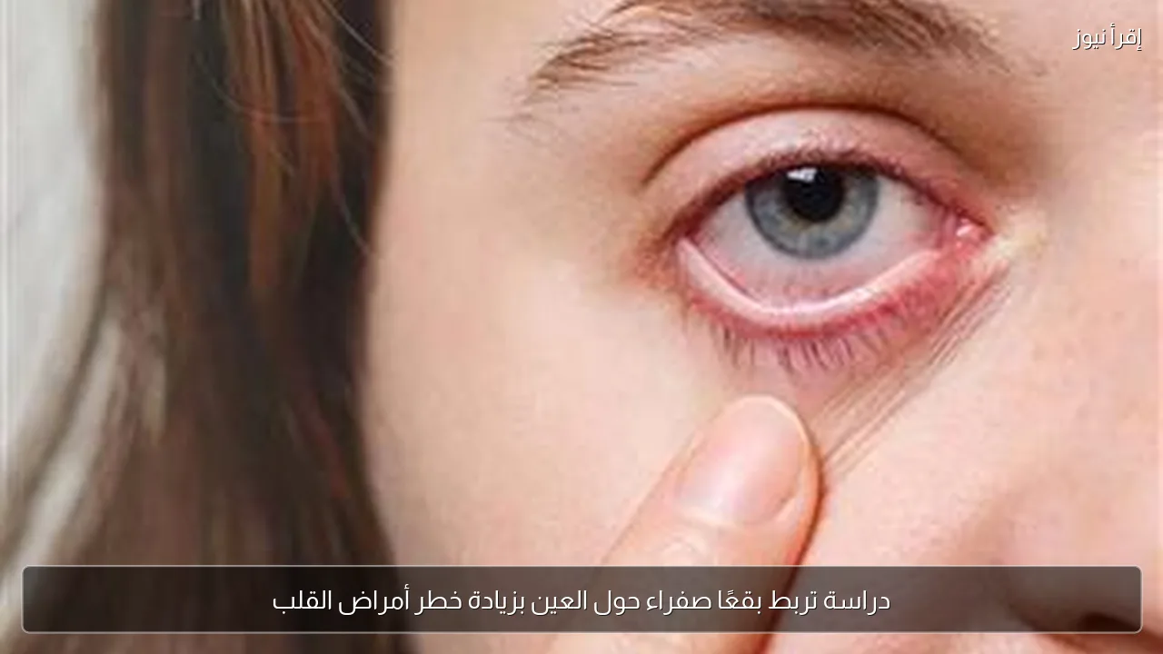 دراسة تربط بقعًا صفراء حول العين بزيادة خطر أمراض القلب