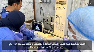 أسيوط: إنقاذ حياة طفل حديث الولادة بقسطرة قلبية علاجية من نوع Rashkind Atrial Septostomy