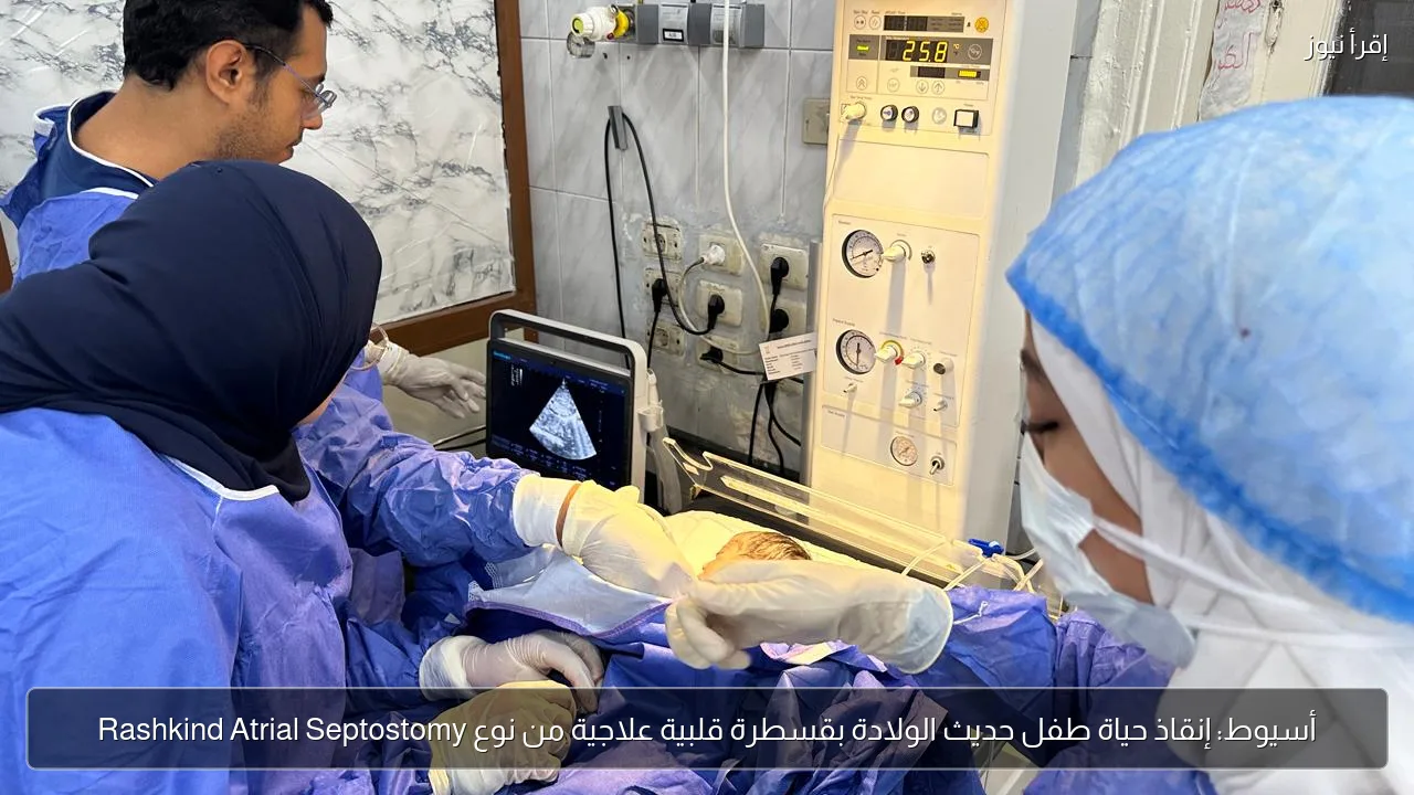 أسيوط: إنقاذ حياة طفل حديث الولادة بقسطرة قلبية علاجية من نوع Rashkind Atrial Septostomy