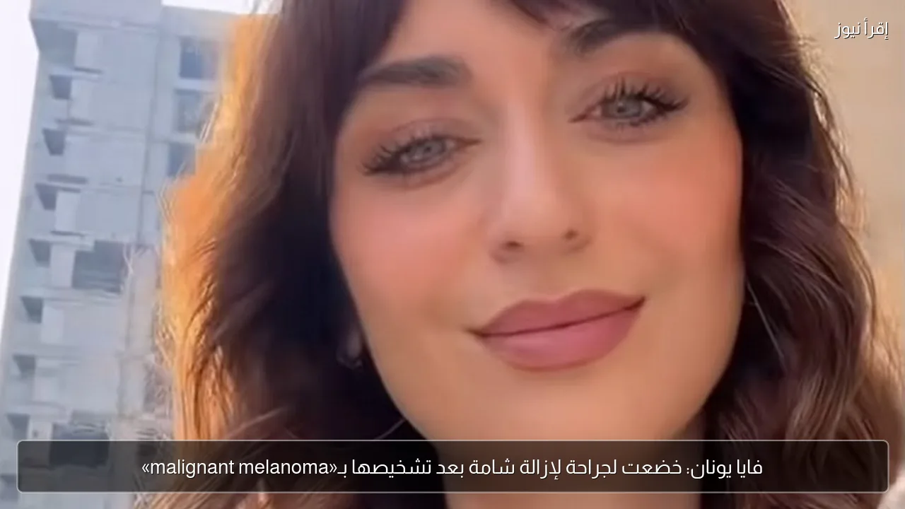 فايا يونان: خضعت لجراحة لإزالة شامة بعد تشخيصها بـ«malignant melanoma»