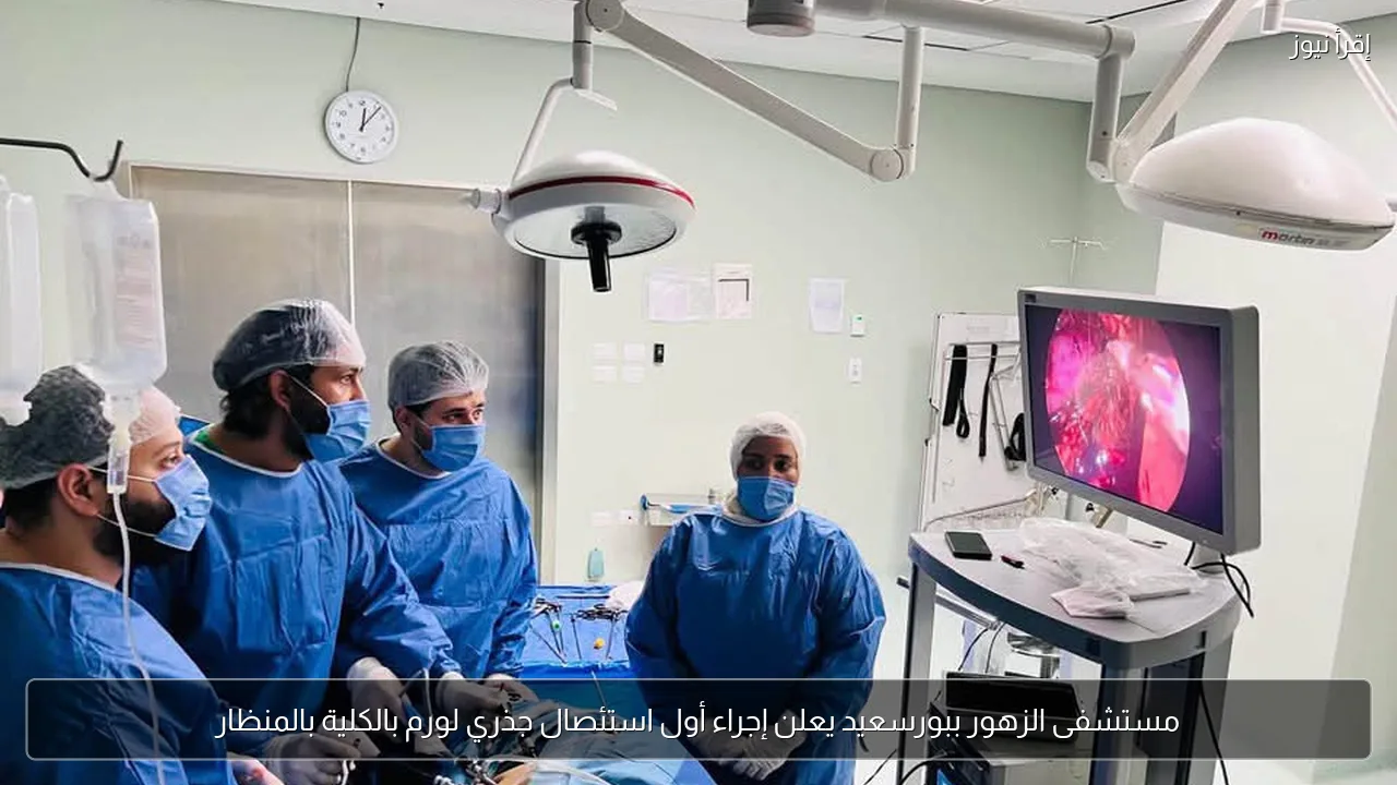 مستشفى الزهور ببورسعيد يعلن إجراء أول استئصال جذري لورم بالكلية بالمنظار