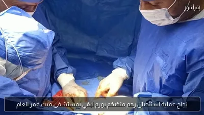 نجاح عملية استئصال رحم متضخم بورم ليفي بمستشفى ميت غمر العام