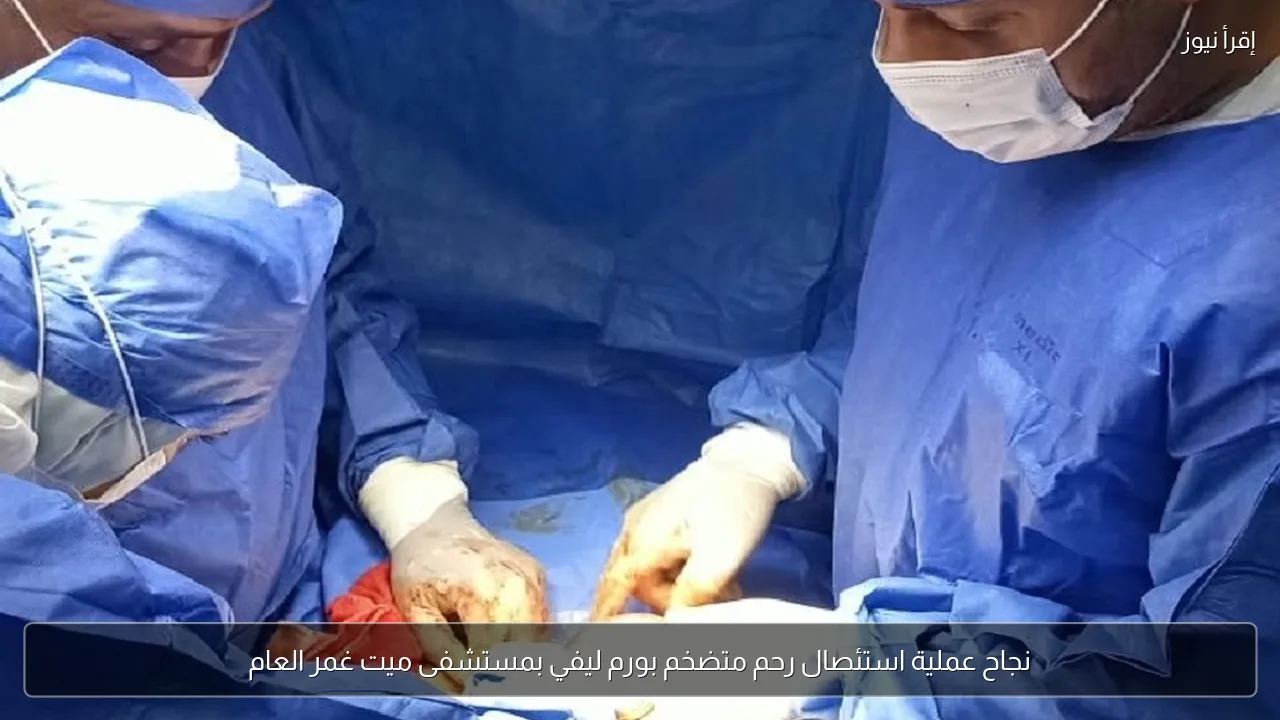 نجاح عملية استئصال رحم متضخم بورم ليفي بمستشفى ميت غمر العام