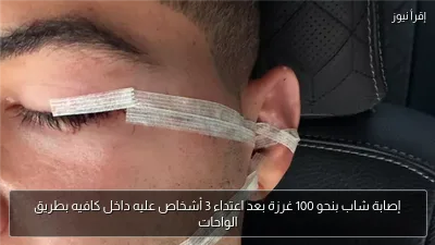 إصابة شاب بنحو 100 غرزة بعد اعتداء 3 أشخاص عليه داخل كافيه بطريق الواحات