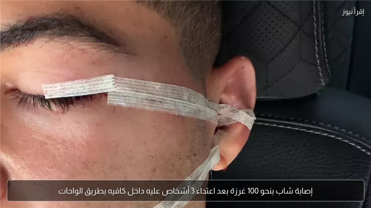 إصابة شاب بنحو 100 غرزة بعد اعتداء 3 أشخاص عليه داخل كافيه بطريق الواحات