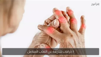 3 خرافات شائعة عن التهاب المفاصل