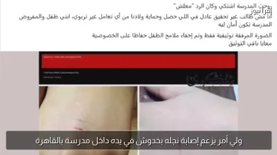 ولي أمر يزعم إصابة نجله بخدوش في يده داخل مدرسة بالقاهرة