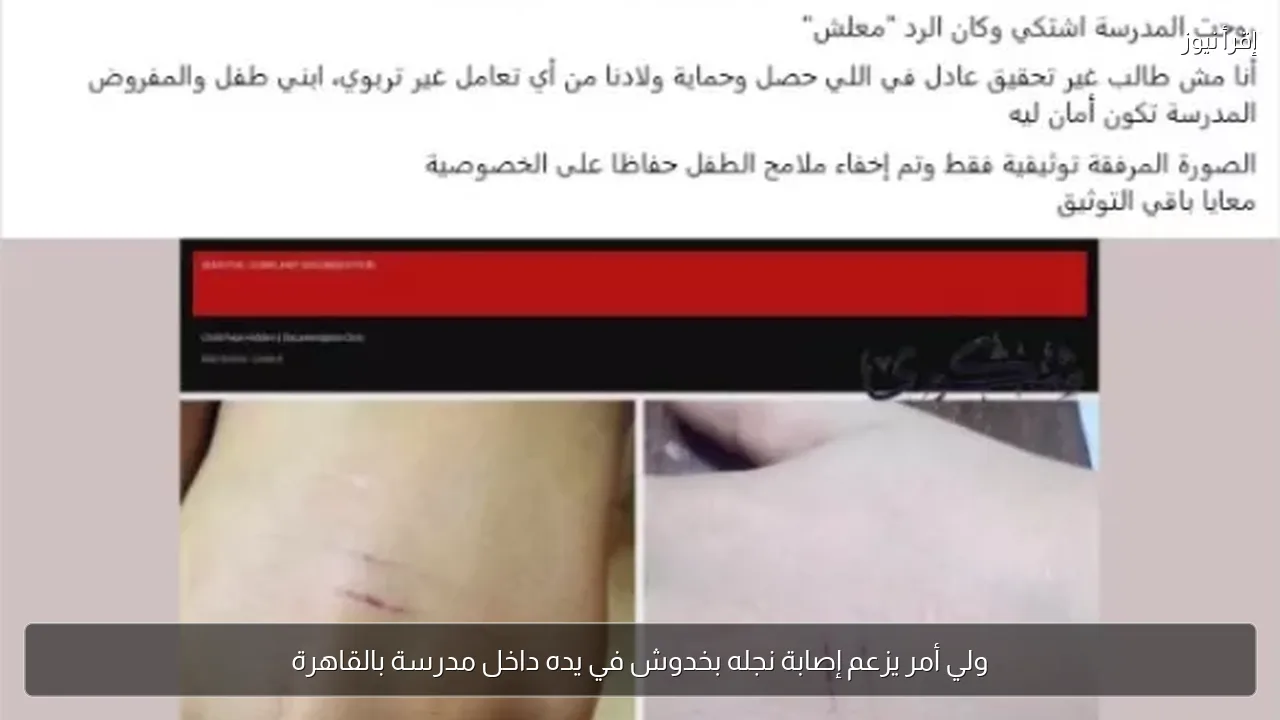 ولي أمر يزعم إصابة نجله بخدوش في يده داخل مدرسة بالقاهرة