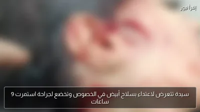 سيدة تتعرض لاعتداء بسلاح أبيض في الخصوص وتخضع لجراحة استمرت 9 ساعات