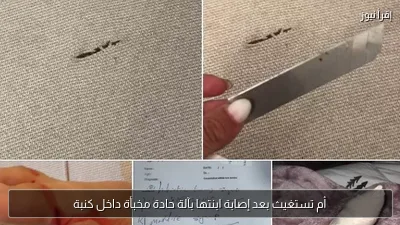 أم تستغيث بعد إصابة ابنتها بآلة حادة مخبأة داخل كنبة