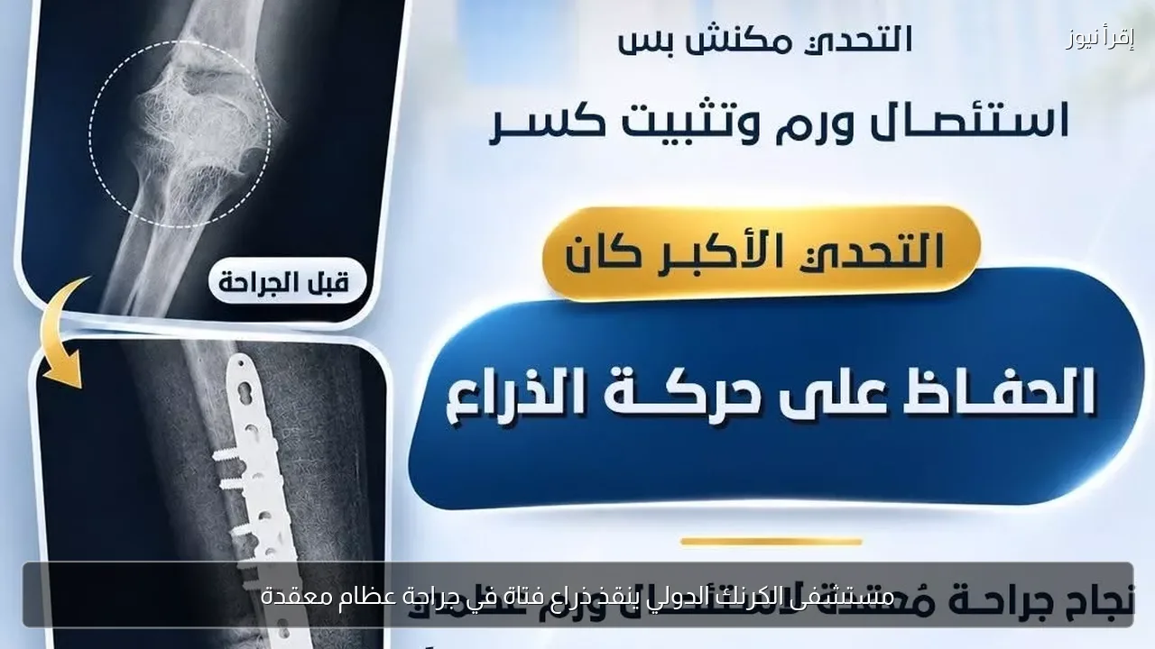 مستشفى الكرنك الدولي ينقذ ذراع فتاة في جراحة عظام معقدة