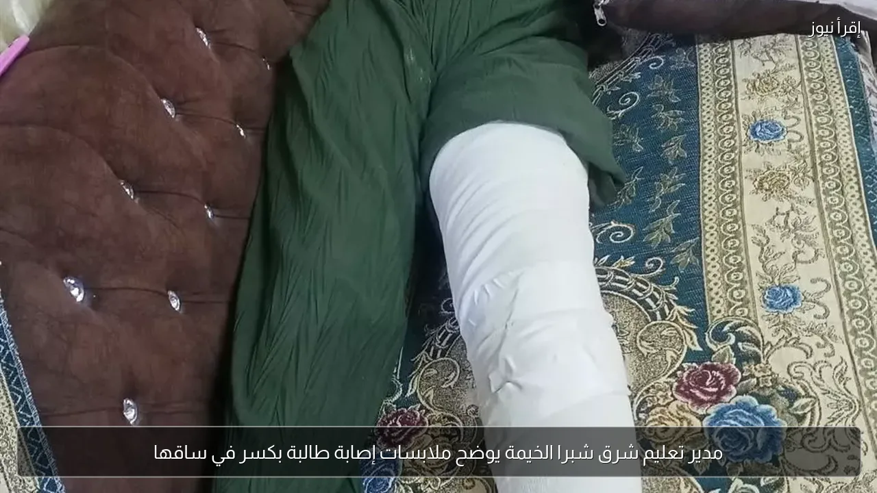 مدير تعليم شرق شبرا الخيمة يوضح ملابسات إصابة طالبة بكسر في ساقها