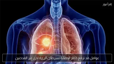 عوامل قد ترفع خطر الإصابة بسرطان الرئة لدى غير المدخنين