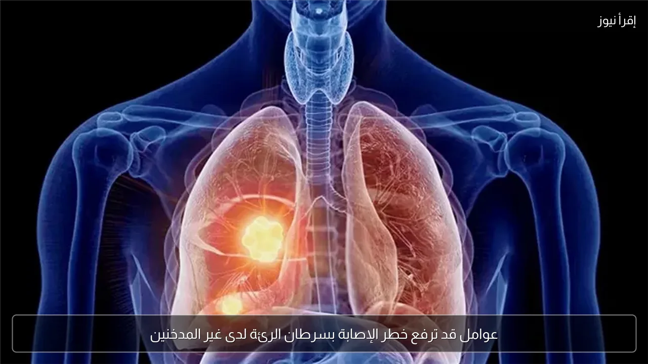 عوامل قد ترفع خطر الإصابة بسرطان الرئة لدى غير المدخنين