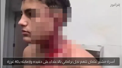 أسرة مشير عثمان تتهم نجل برلماني بالاعتداء على حفيده وإصابته بـ40 غرزة