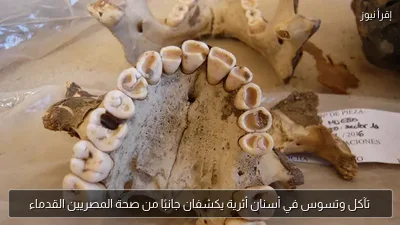 تآكل وتسوس في أسنان أثرية يكشفان جانبًا من صحة المصريين القدماء