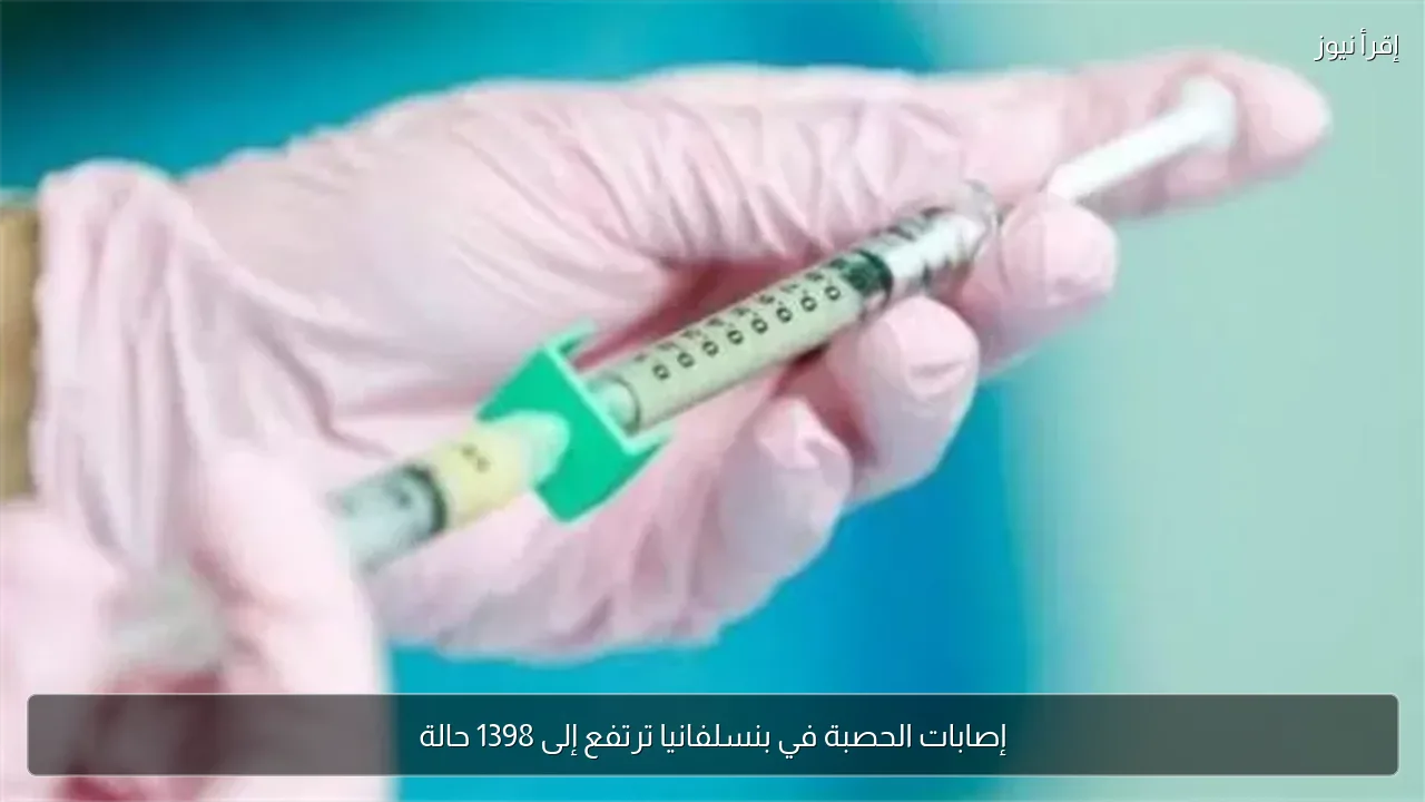 إصابات الحصبة في بنسلفانيا ترتفع إلى 1398 حالة