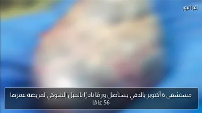 مستشفى 6 أكتوبر بالدقي يستأصل ورمًا نادرًا بالحبل الشوكي لمريضة عمرها 56 عامًا