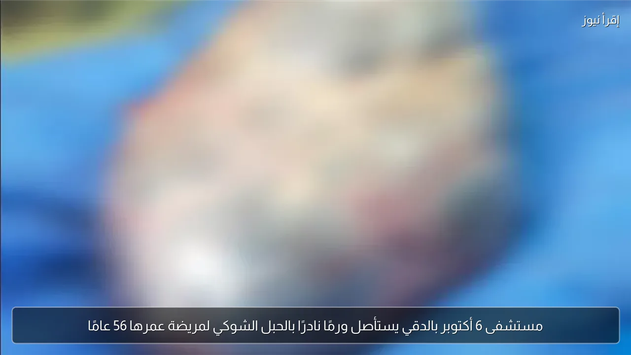 مستشفى 6 أكتوبر بالدقي يستأصل ورمًا نادرًا بالحبل الشوكي لمريضة عمرها 56 عامًا
