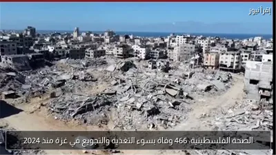 الصحة الفلسطينية: 466 وفاة بسوء التغذية والتجويع في غزة منذ 2024