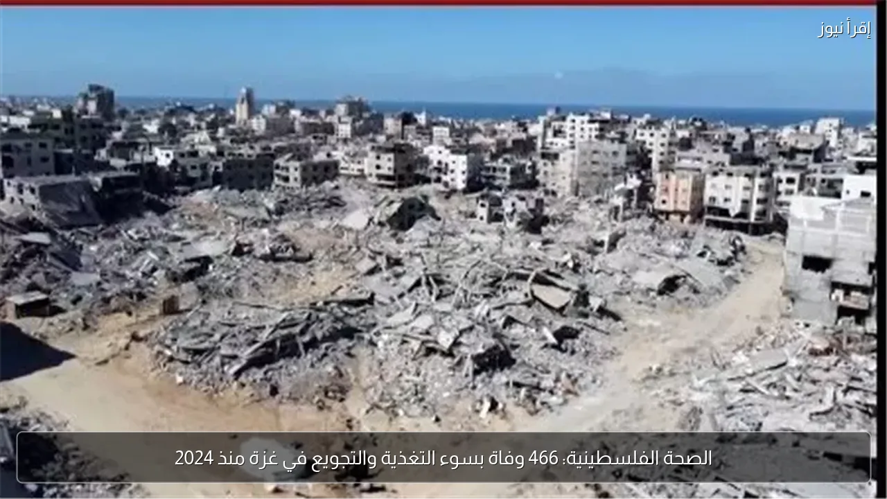 الصحة الفلسطينية: 466 وفاة بسوء التغذية والتجويع في غزة منذ 2024
