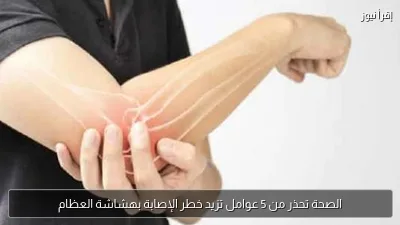الصحة تحذر من 5 عوامل تزيد خطر الإصابة بهشاشة العظام
