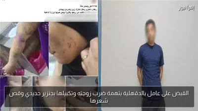 القبض على عامل بالدقهلية بتهمة ضرب زوجته وتكبيلها بجنزير حديدي وقص شعرها