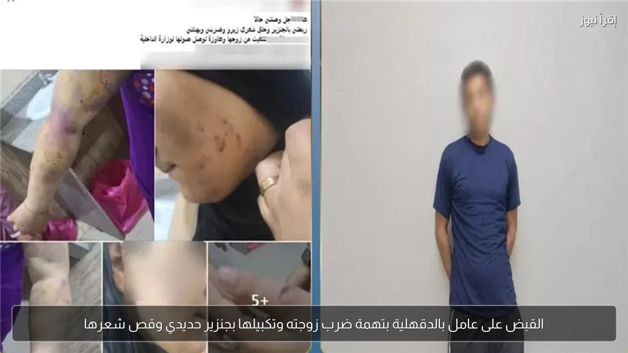 القبض على عامل بالدقهلية بتهمة ضرب زوجته وتكبيلها بجنزير حديدي وقص شعرها