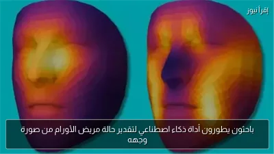 باحثون يطورون أداة ذكاء اصطناعي لتقدير حالة مريض الأورام من صورة وجهه