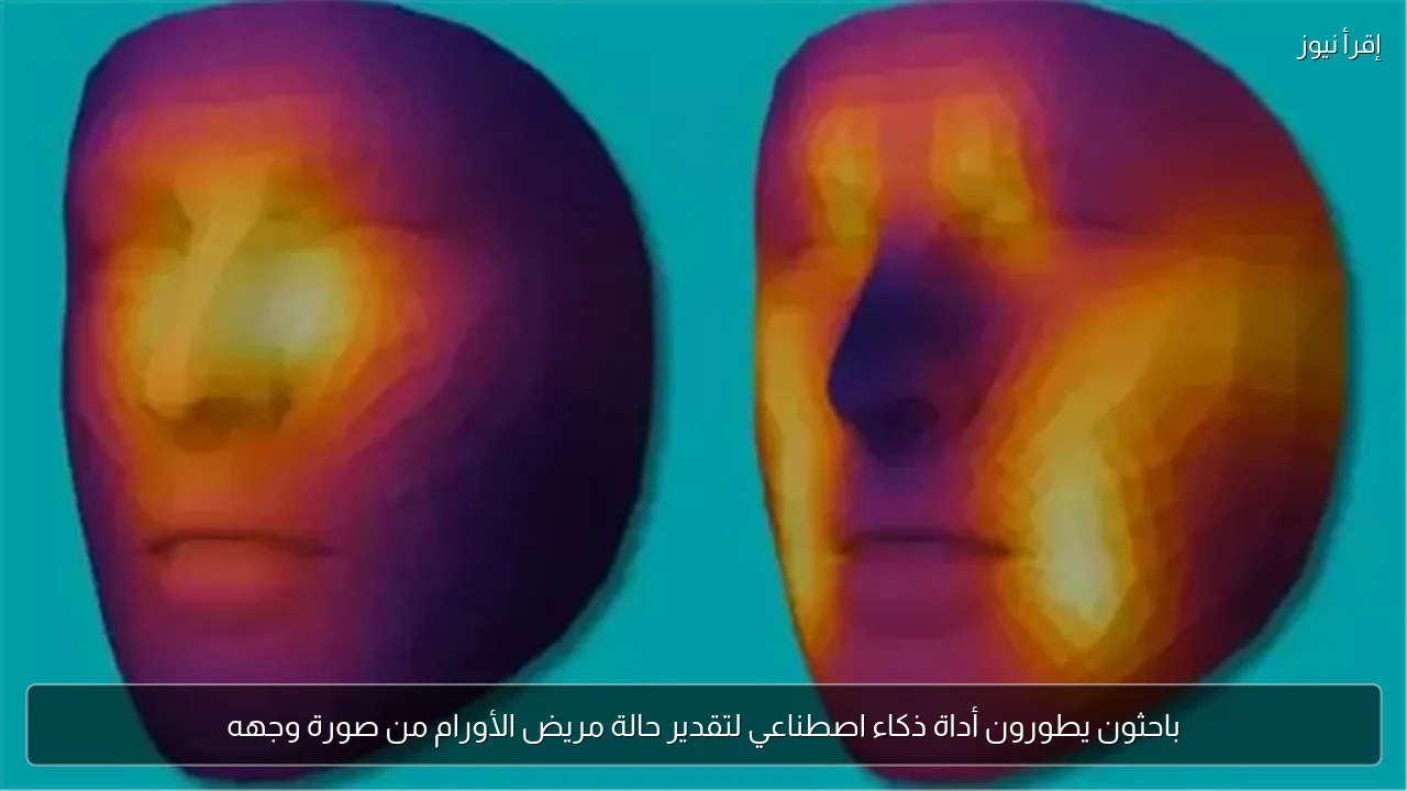 باحثون يطورون أداة ذكاء اصطناعي لتقدير حالة مريض الأورام من صورة وجهه