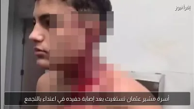أسرة مشير عثمان تستغيث بعد إصابة حفيده في اعتداء بالتجمع