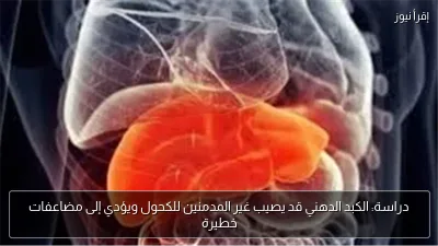 دراسة: الكبد الدهني قد يصيب غير المدمنين للكحول ويؤدي إلى مضاعفات خطيرة
