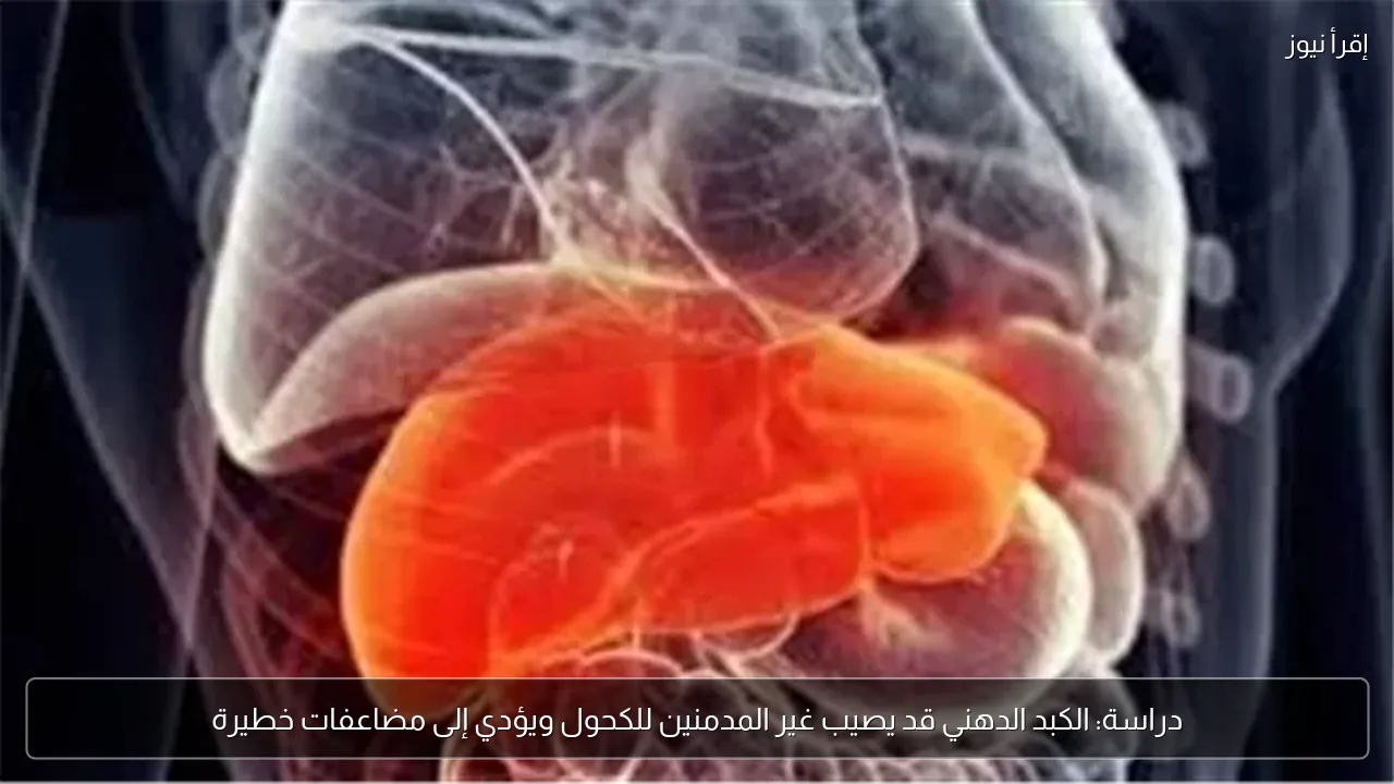 دراسة: الكبد الدهني قد يصيب غير المدمنين للكحول ويؤدي إلى مضاعفات خطيرة