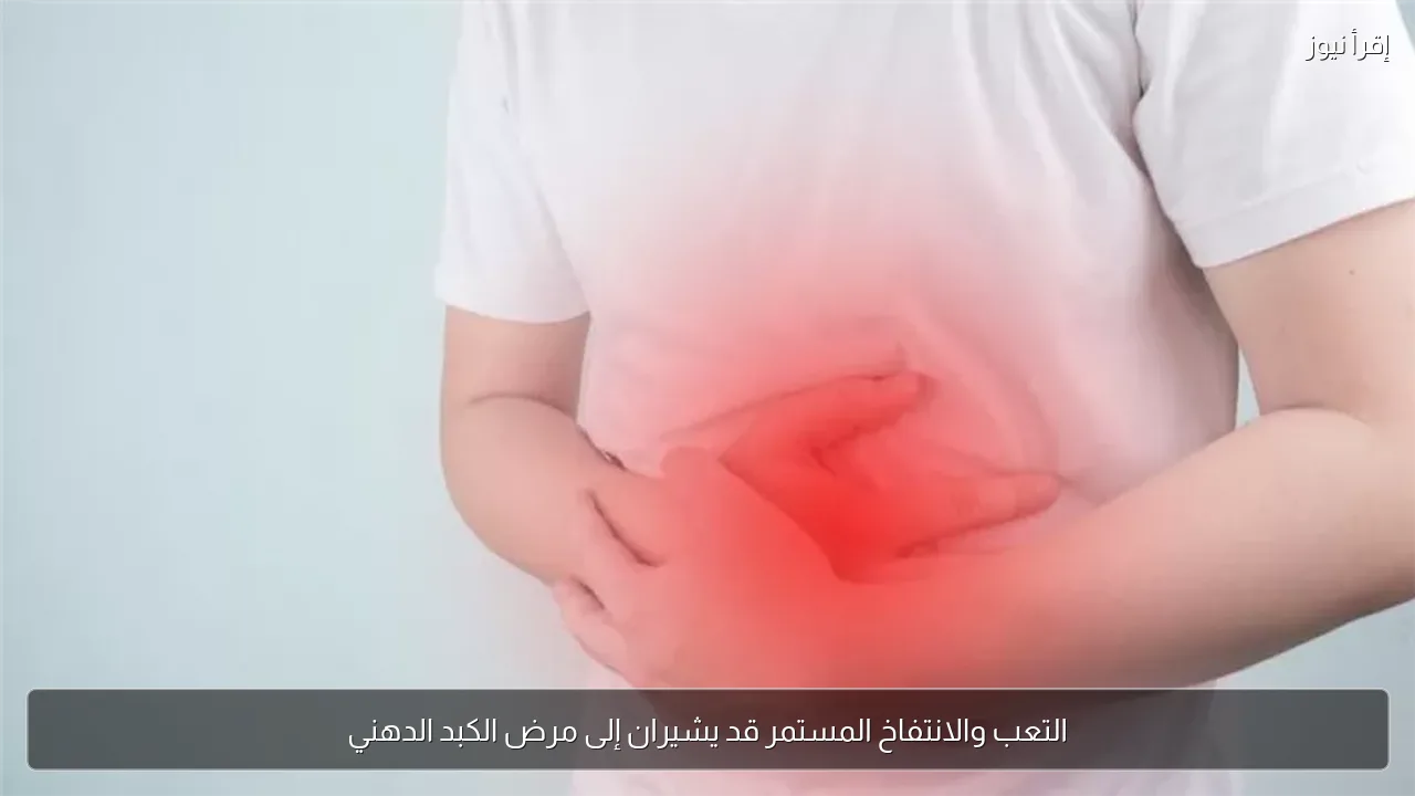 التعب والانتفاخ المستمر قد يشيران إلى مرض الكبد الدهني