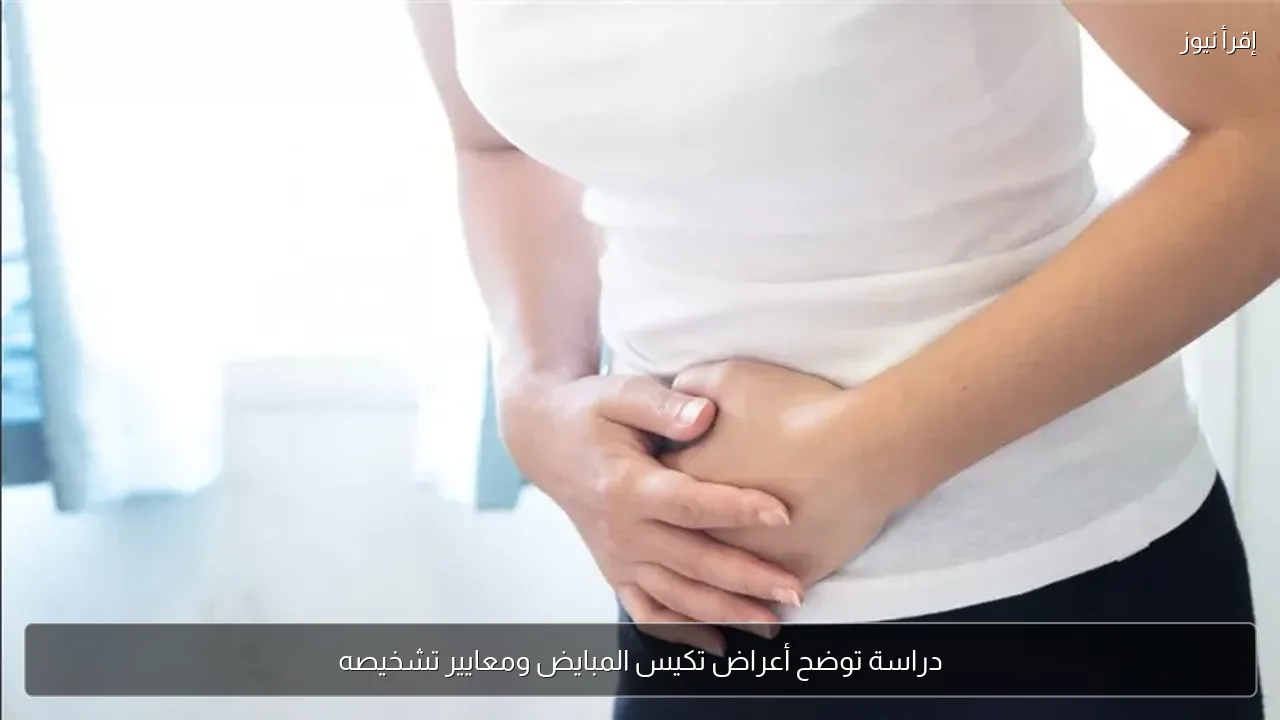 دراسة توضح أعراض تكيس المبايض ومعايير تشخيصه