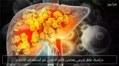 دراسة: عقار تجريبي يعكس الكبد الدهني عبر استهداف الأمعاء