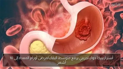 أسترازينيكا: دواء تجريبي يرفع متوسط البقاء لمرضى أورام المعدة إلى 10 أشهر