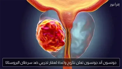 جونسون آند جونسون تعلن نتائج واعدة لعقار تجريبي ضد سرطان البروستاتا