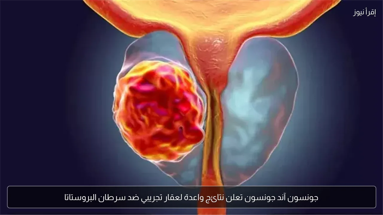 جونسون آند جونسون تعلن نتائج واعدة لعقار تجريبي ضد سرطان البروستاتا