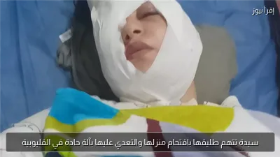 سيدة تتهم طليقها باقتحام منزلها والتعدي عليها بآلة حادة في القليوبية