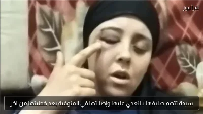 سيدة تتهم طليقها بالتعدي عليها وإصابتها في المنوفية بعد خطبتها من آخر