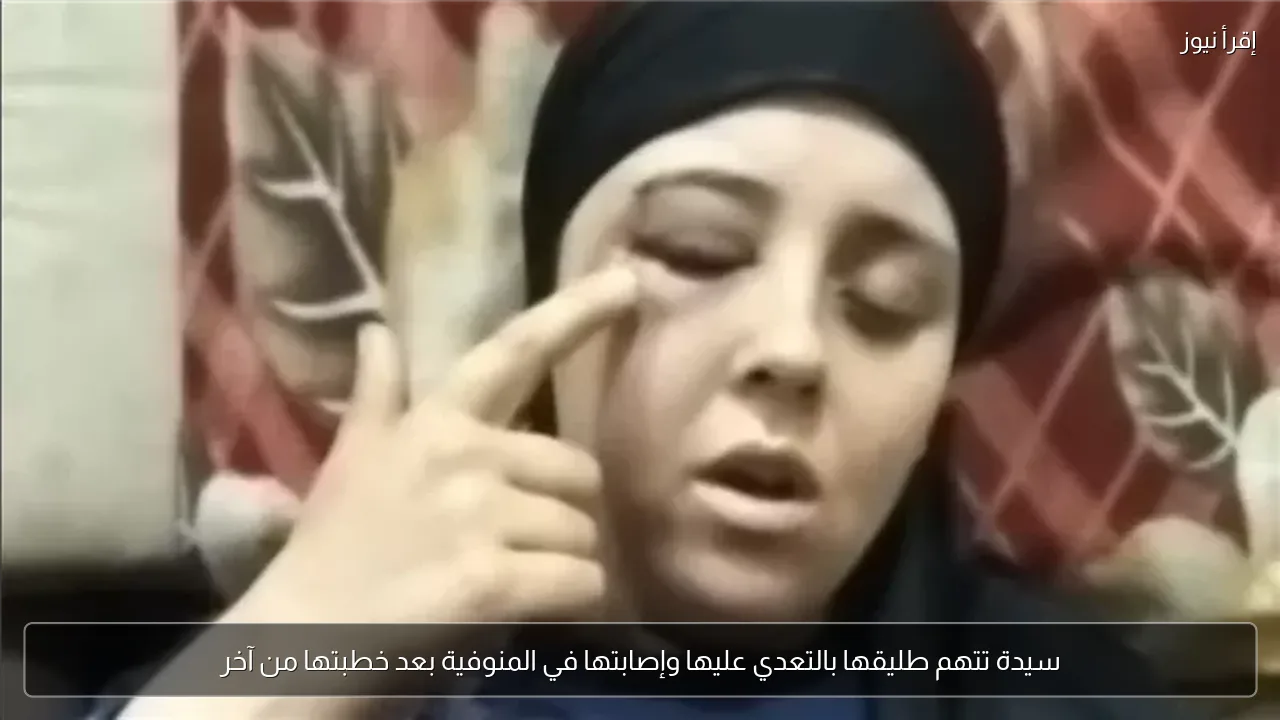 سيدة تتهم طليقها بالتعدي عليها وإصابتها في المنوفية بعد خطبتها من آخر