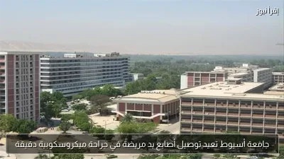 جامعة أسيوط تعيد توصيل أصابع يد مريضة في جراحة ميكروسكوبية دقيقة