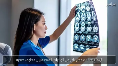 ارتفاع إصابات فطر نادر في الولايات المتحدة يثير مخاوف صحية