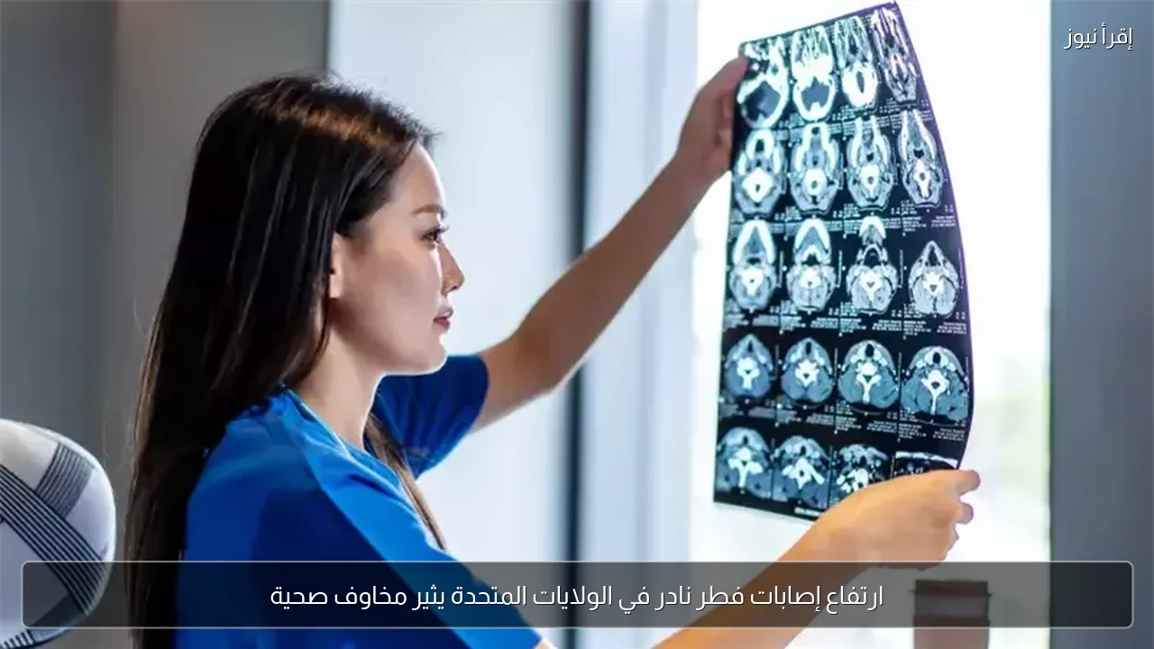ارتفاع إصابات فطر نادر في الولايات المتحدة يثير مخاوف صحية