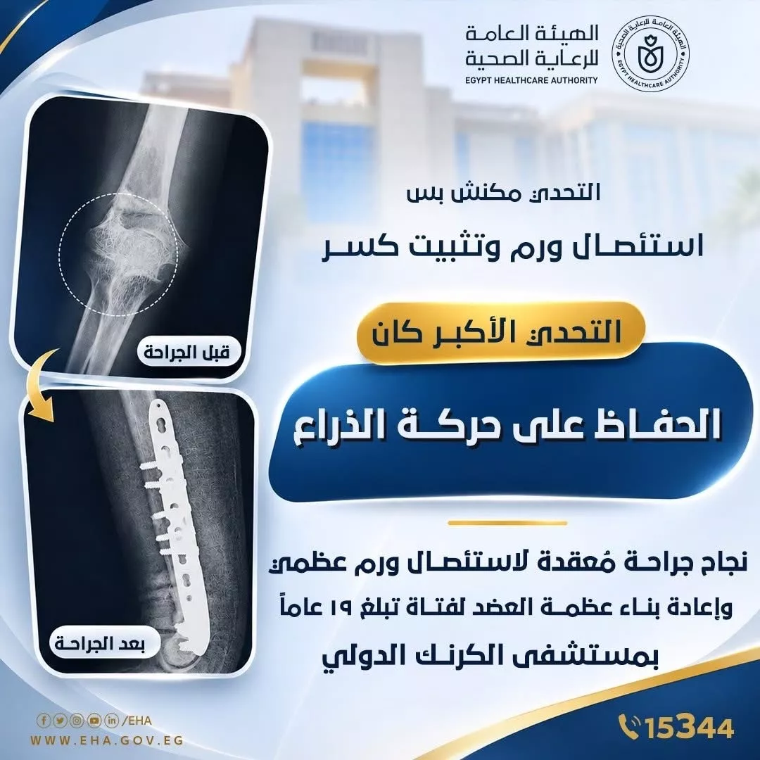 إنقاذ ذراع فتاة بمستشفى الكرنك بالاقصر