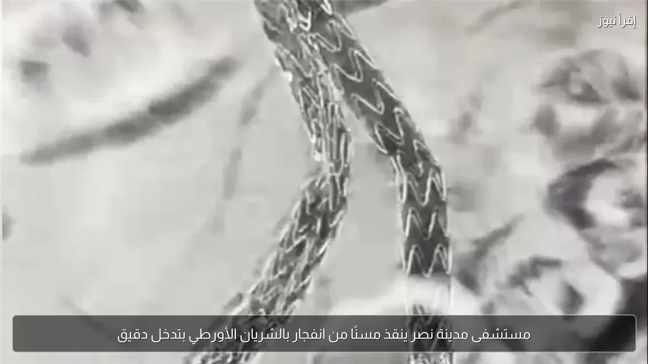 مستشفى مدينة نصر ينقذ مسنًا من انفجار بالشريان الأورطي بتدخل دقيق