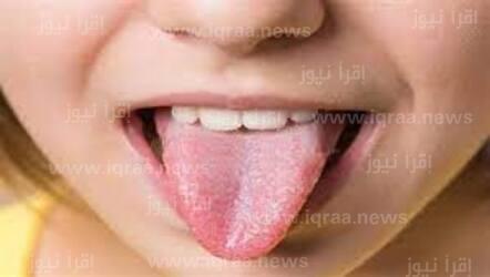 بالك.. علامة في الفم تكشف الإصابة عن بـ السرطان